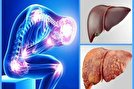 علایم ابتلا به کبد چرب